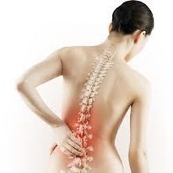 osteoporoz-u-zhenshhin